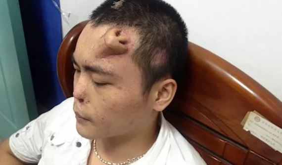 people with extra body parts