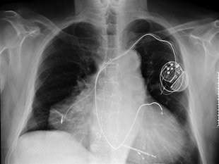 people with extra body parts